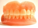 Dantų implantų rūšys